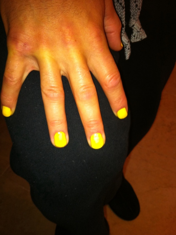 Yankees Catcher Russell Martin Paints Fingernails Bright Yellow, Shows Off Picture on Twitter