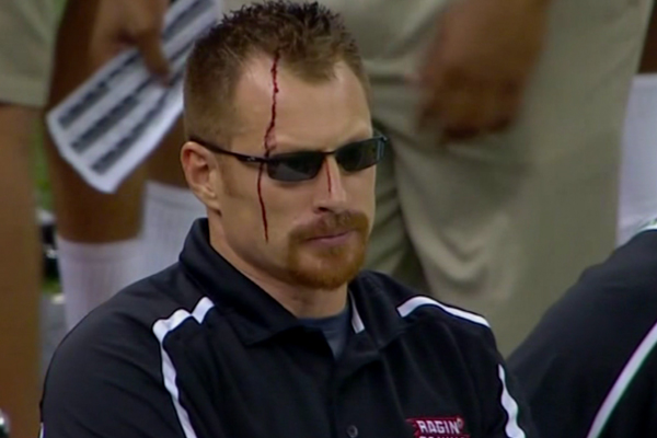 Louisiana-Lafayette Coach Rusty Whitt Bleeds From Head, Stays on Sideline During New Orleans Bowl Win (Photos)