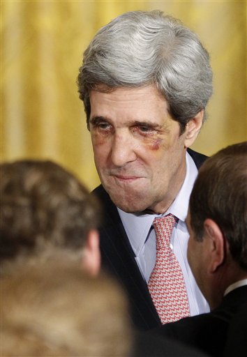 Senator John Kerry Sporting Broken Nose, Black Eyes During Bruins' Meeting With President Barack Obama