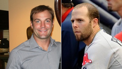 Wes Welker Doesn't Convince Dustin Pedroia, Who Says He's 'Plenty Good Looking' Without Hair Adjustment