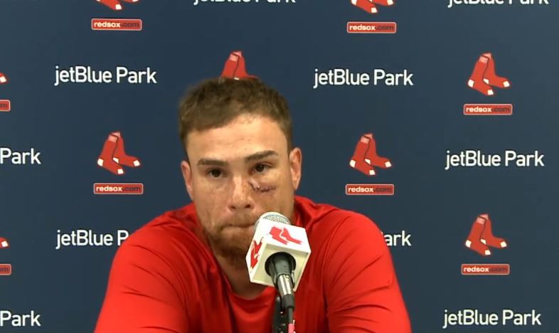 Red Sox catcher Christian Vazquez says he's done wearing a sliding glove on  basepaths - Hand Surgery, PC