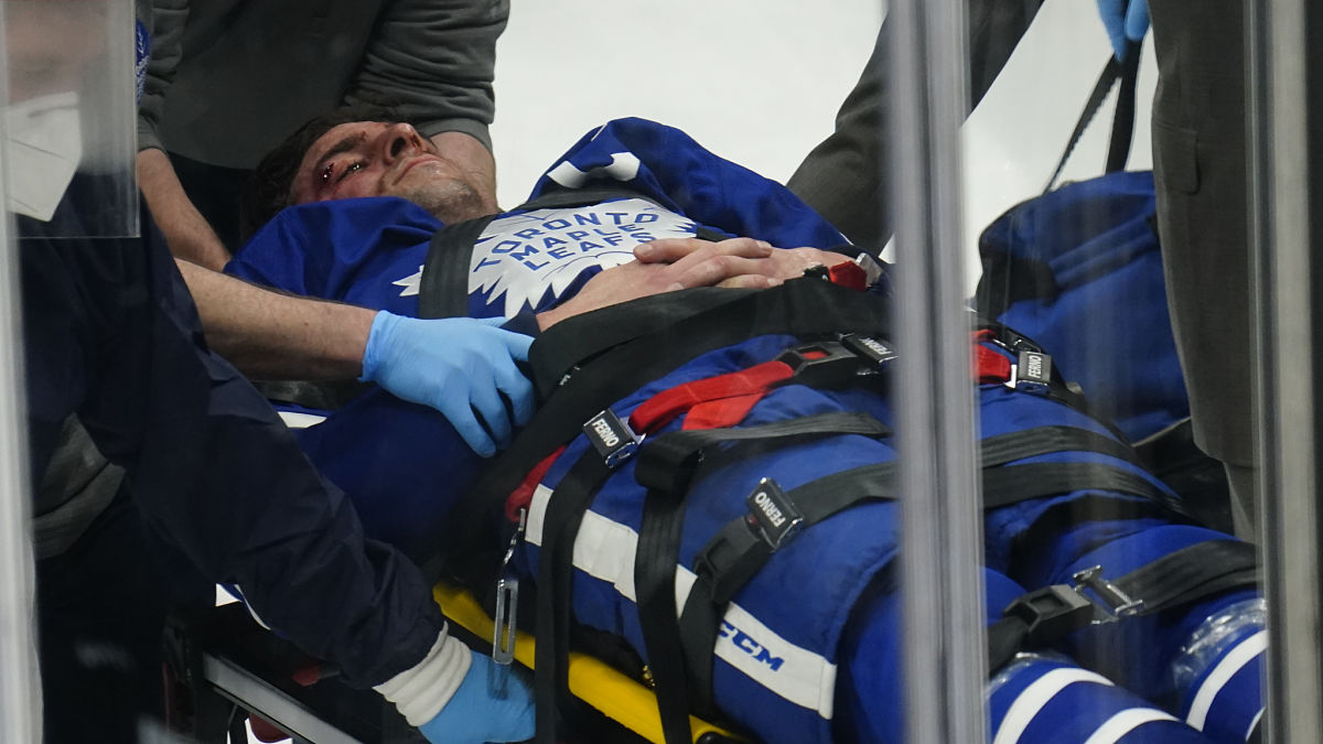Brad Marchand Reacts To Scary Scene Involving Maple Leafs’ John Tavares