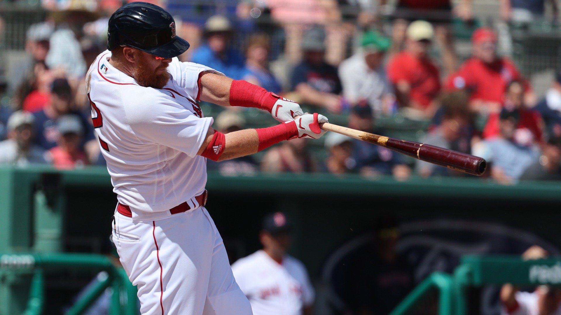 Boston Red Sox infielder Justin Turner gets 16 stitches after